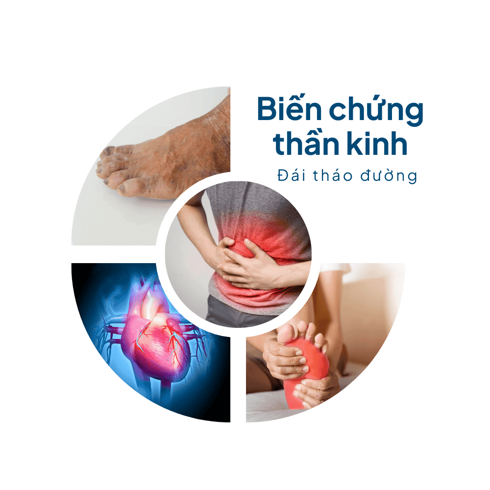 Biến chứng thần kinh đái tháo đường: cảnh báo nhận diện sớm