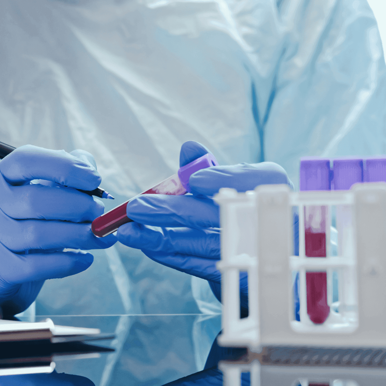 Phát hiện và điều trị đái tháo đường với xét nghiệm FPG