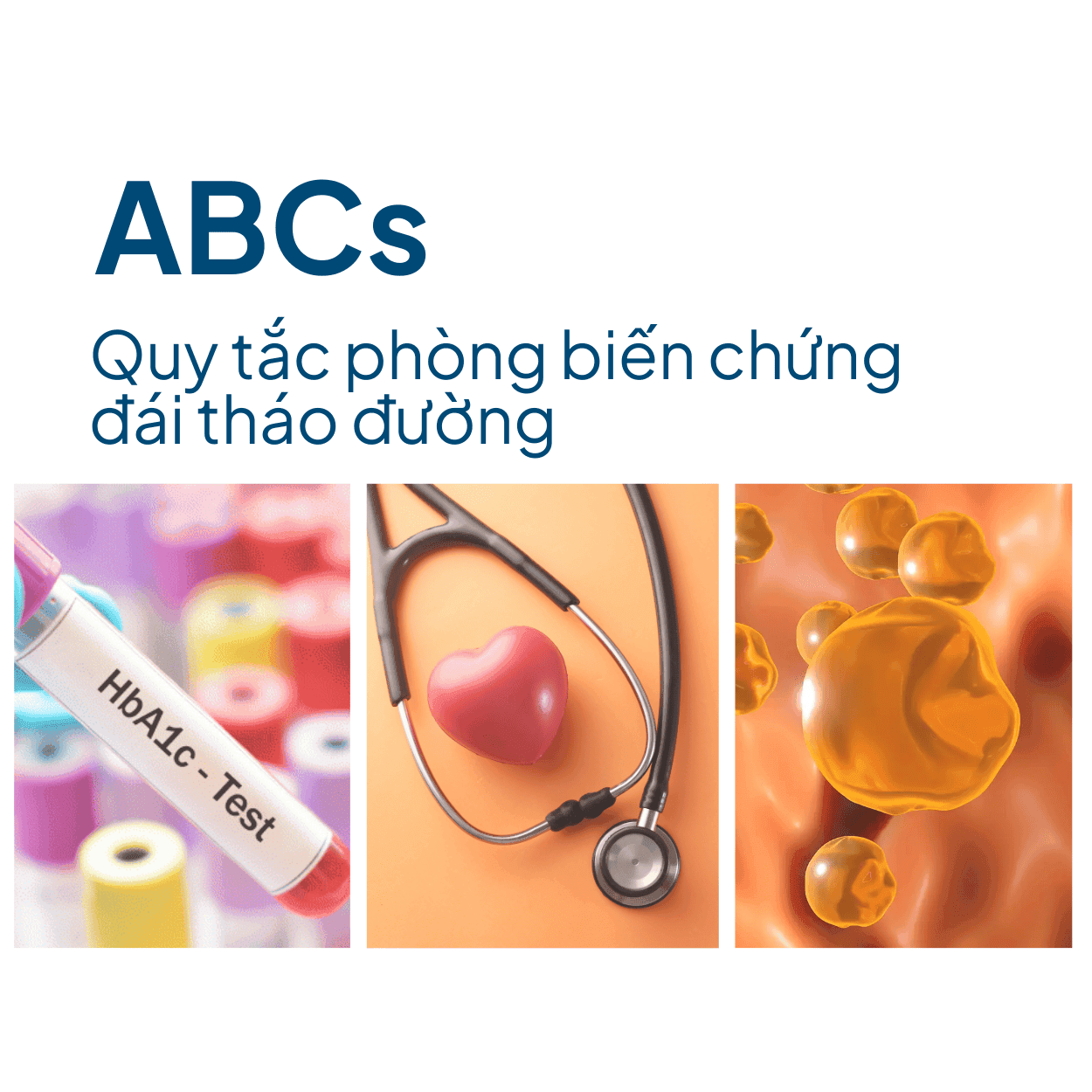 Phòng ngừa và kiểm soát tiểu đường với quy tắc ABCs